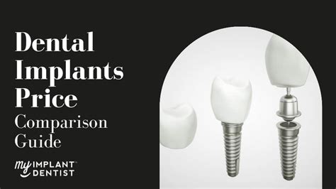 dental implants cost in cambodia|Dental Implants Price Comparison .